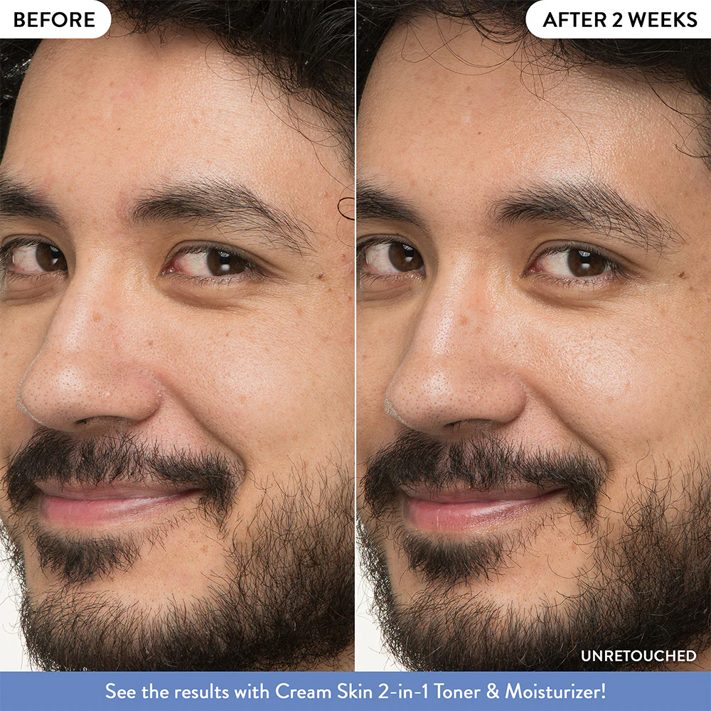 LN_Cream_Skin_B_A_NEW_1000x1000_After2Weeks_2_f6946d3a-55d3-4f1f-a426-784adc4f746c_jpgv1724625485