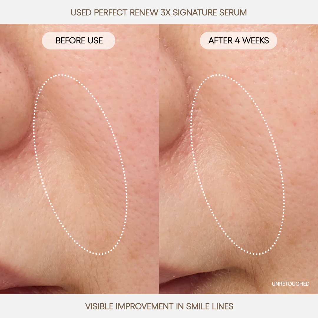 PRS_B_A2_2000x2000_160defb2-2e08-4fee-bf56-78f0f123a1bc_jpgv1749212184