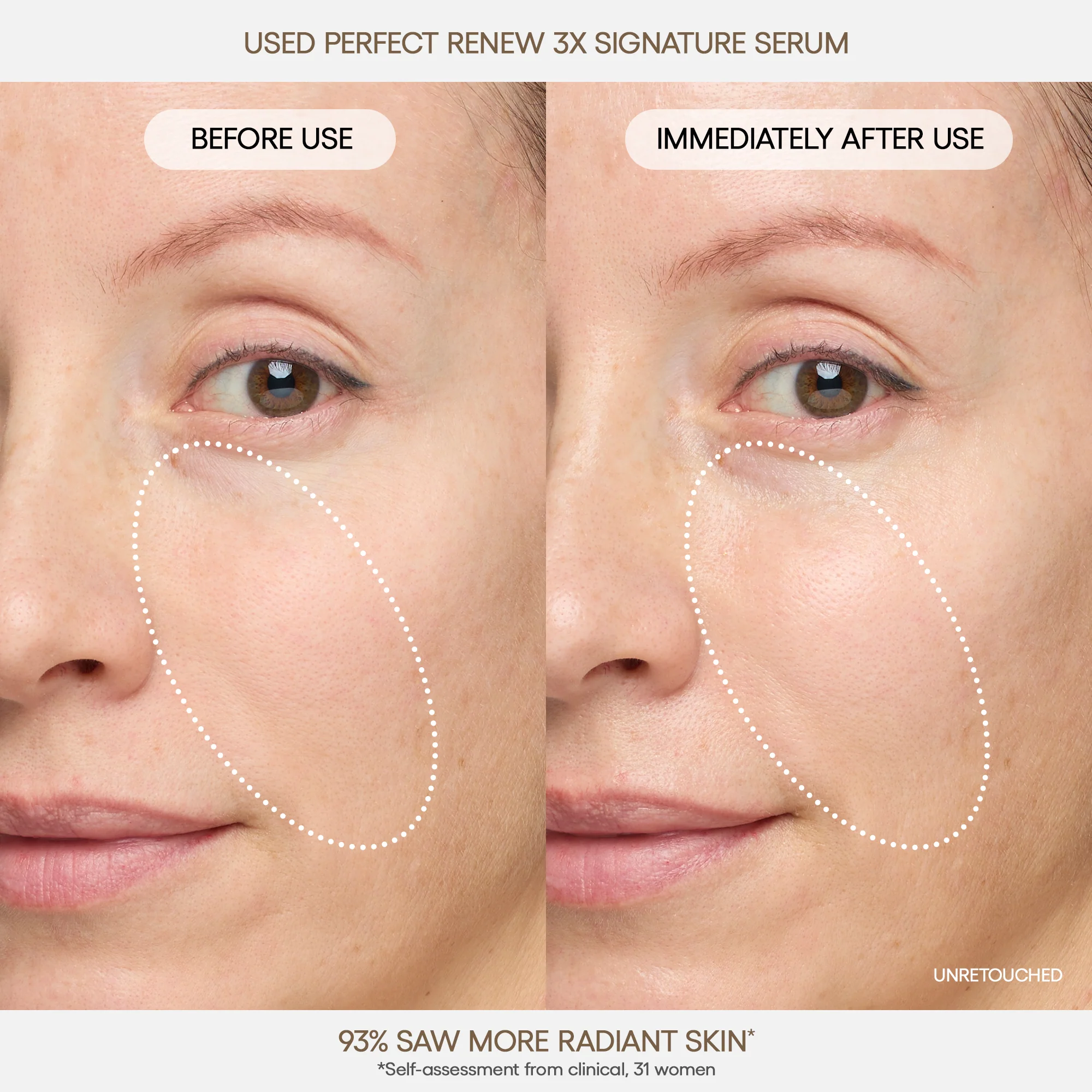 PRS_B_A3_2000x2000_fdcc7ca0-3e64-4fe5-bbea-78c5ac9625f6_jpgv1749212184