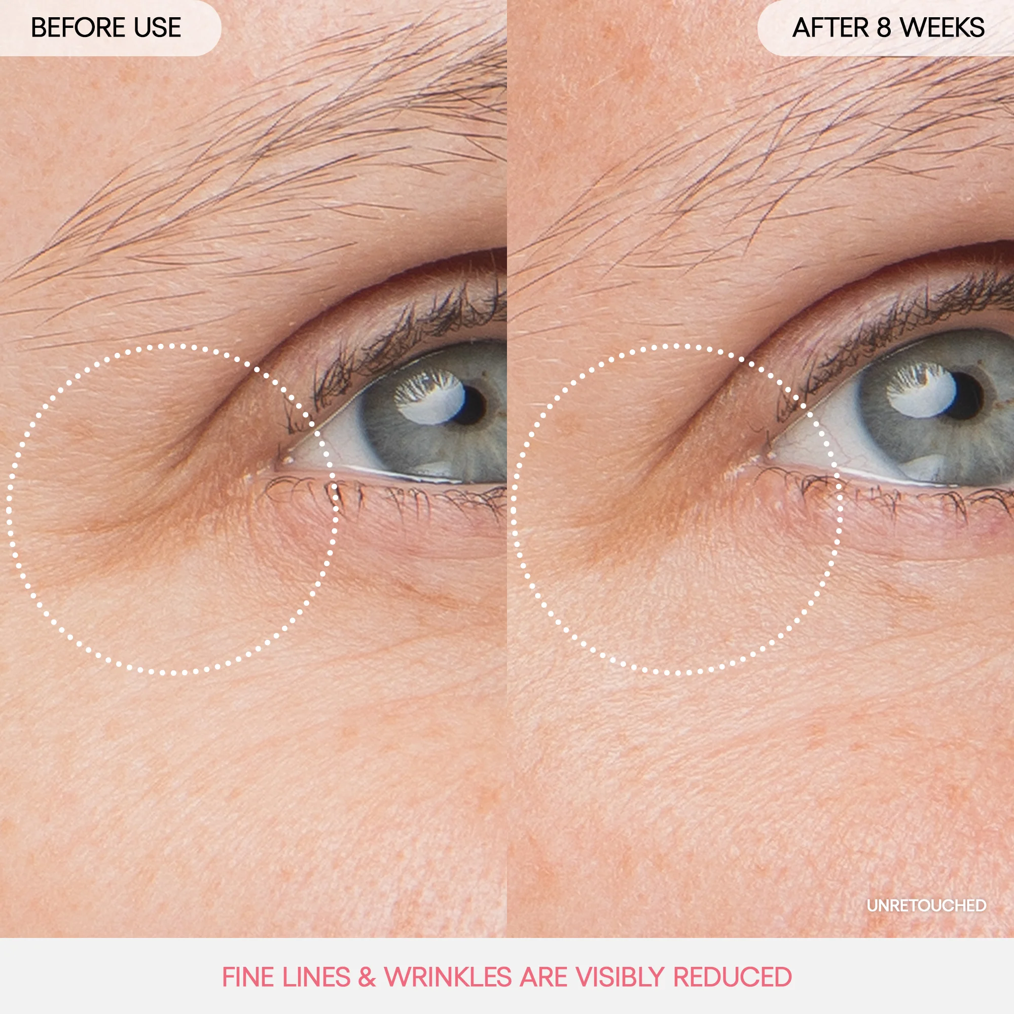 PT05_65e52e07-dc7b-4215-9474-55675f57150d_jpgv1741791292